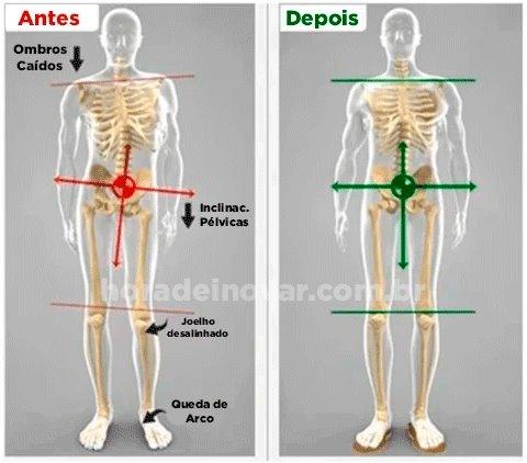 Tênis MaxConfort Feminino - Tratamento Ortopédico - Lojas Promorin